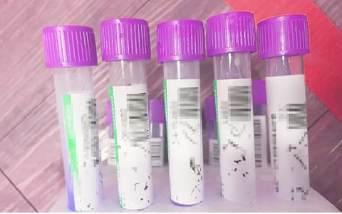 祝賀我司中標(biāo)江蘇某地核酸檢測條碼制作項目